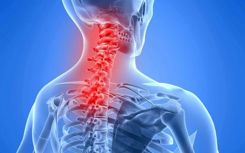 Neck Pain overview