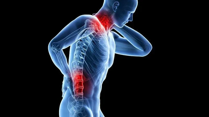 Symptoms and patterns associated with Scoliosis