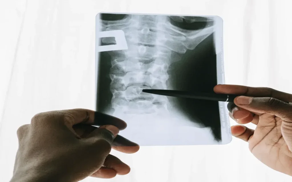 X-Ray Imaging overview