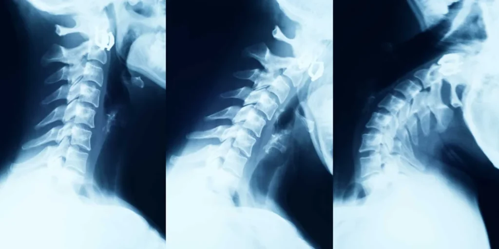 Preparing for a X-Ray Imaging visit
