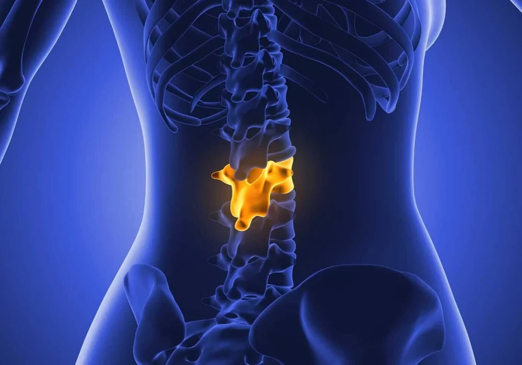 Decompression Therapy overview